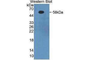 Western blot analysis of recombinant Human FGb.