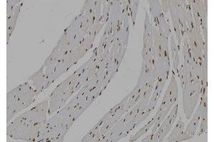 ABIN6277535 at 1/100 staining Mouse heart tissue by IHC-P. (IMPDH2 anticorps  (Internal Region))