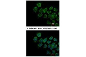 ICC/IF Image Immunofluorescence analysis of methanol-fixed Hep3B, using IFNAR2, antibody at 1:500 dilution.
