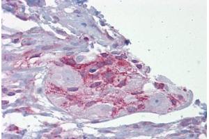 Anti-ASPH antibody IHC staining of human small intestine and myenteric plexus.