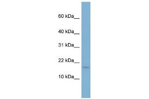 WB Suggested Anti-RPS13 Antibody Titration: 0. (RPS13 anticorps  (N-Term))