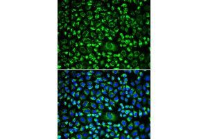 Immunofluorescence analysis of HeLa cells using TAPBP antibody. (TAPBP anticorps)