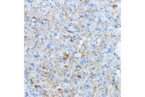 Immunohistochemistry of paraffin-embedded rat ovary using Aromatase (CYP19) antibody (2684) at dilution of 1:100 (40x lens). (Aromatase anticorps  (AA 1-180))