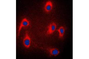 Immunofluorescent analysis of JIP3 staining in PC12 cells. (JIP3 anticorps  (Center))
