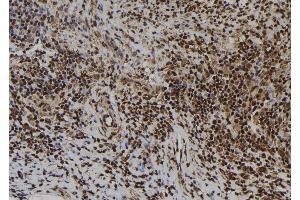 ABIN6273425 at 1/100 staining Human spleen tissue by IHC-P. (ATRAID anticorps  (Internal Region))