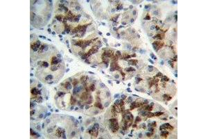 IHC analysis of FFPE human stomach and CTGF antibody