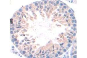 Figure. (FAM135B anticorps  (AA 1068-1403))