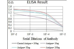Black line: Control Antigen (100 ng), Purple line: Antigen(10 ng), Blue line: Antigen (50 ng), Red line: Antigen (100 ng),
