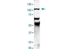 Immunoprecipitation of rat brain homogenate with EEA1 polyclonal antibody  at 1:500 dilution. (EEA1 anticorps  (N-Term))