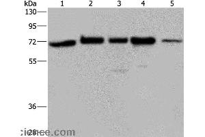 Western blot analysis of A172, Hela and 293T cell, K562 cell and human testis tissue, using AGFG1 Polyclonal Antibody at dilution of 1:727 (AGFG1 anticorps)