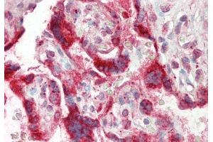 Rabbit Anti-TSC22D2 antibody  Formalin Fixed Paraffin Embedded Tissue: Human Placenta Primary antibody Concentration: 1:100 Secondary Antibody: Donkey anti-Rabbit-Cy3 Secondary Antibody Concentration: 1:200 Magnification: 20x Exposure Time: 0. (TSC22D2 anticorps  (N-Term))