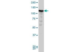 NOPE monoclonal antibody (M03), clone 6E6 Western Blot analysis of NOPE expression in HeLa . (IGDCC4 anticorps  (AA 1152-1250))