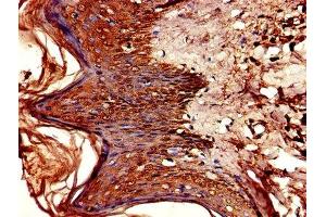 Immunohistochemistry of paraffin-embedded human skin tissue using ABIN7154406 at dilution of 1:100