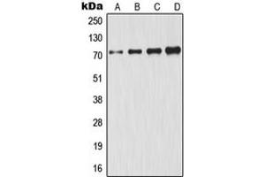 Western blot analysis of GCLC expression in HeLa (A), A431 (B), Jurkat (C), HepG2 (D) whole cell lysates. (GCLC anticorps  (Center))