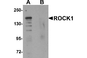 Western blot analysis of ROCK1 in 293 cell lysate with ROCK1 antibody at 1 µg/mL in (A) the absence and (B) the presence of blocking peptide. (ROCK1 anticorps  (N-Term))