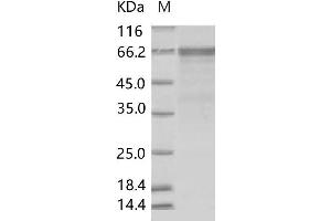 Western Blotting (WB) image for Enterovirus D68 VP1 (EV-D68 VP1) protein (Fc Tag) (ABIN7198708) (EV-D68 VP1 Protein (Fc Tag))