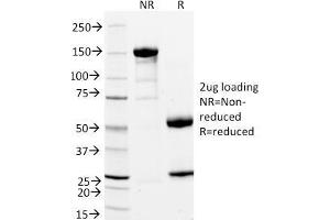 SDS-PAGE Analysis Purified StAR Mouse Monoclonal Antibody (STAR/2154). (STAR anticorps  (AA 39-108))