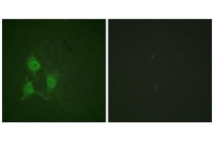 Immunofluorescence (IF) image for anti-PKA alpha/beta Cat (pThr197) antibody (ABIN1847296) (PKA alpha/beta Cat (pThr197) anticorps)