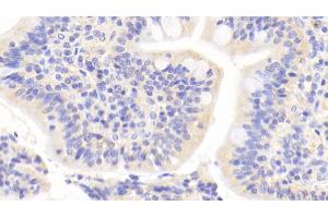 Detection of JNK1 in Human Small intestine Tissue using Polyclonal Antibody to c-Jun N-terminal Kinase 1 (JNK1)