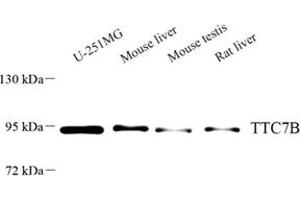 Western blot analysis of TTC7B (ABIN7075876) at dilution of 1: 500