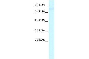 Human HepG2; WB Suggested Anti-ZNF336 Antibody Titration: 0. (ZNF336 anticorps  (N-Term))