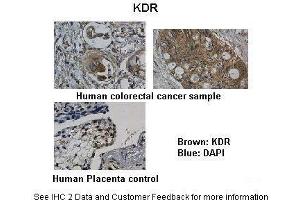 Researcher: Department of Pathology, Hospital de Carabineros de Chile, Santiago, ChileApplication: IHCSpecies+tissue/cell type: Control-Human Placenta, Sample-Human colorectal cancer Primary Antibody dilution: 1:100Secondary Antibody: Biotinylated pig anti-rabbit+streptavidin-HRP (VEGFR2/CD309 anticorps  (N-Term))
