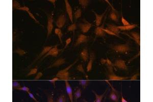 Immunofluorescence analysis of C6 cells using PSMD13 Polyclonal Antibody at dilution of 1:100 (40x lens).