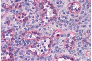 Human Spleen: Formalin-Fixed, Paraffin-Embedded (FFPE)