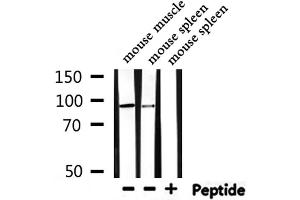 Western blot analysis of extracts from mouse muscle,mouse spleen, using HMGCR Antibody.