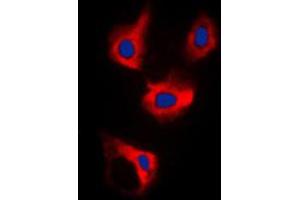 Immunofluorescent analysis of CDCA3 staining in MCF7 cells. (CDCA3 anticorps  (C-Term))