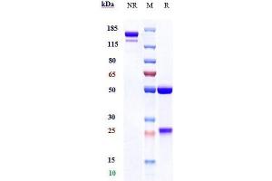 Anti-CSF1R / M-CSFR / CD115 Reference Antibody (cabiralizumab) on SDS-PAGE under reducing (R) condition. (Recombinant CSF1R (Cabiralizumab Biosimilar) anticorps)