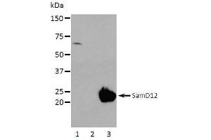 Western Blotting (WB) image for anti-Sterile alpha Motif Domain Containing 12 (SAMD12) (full length) antibody (ABIN2443898) (SAMD12 anticorps  (full length))