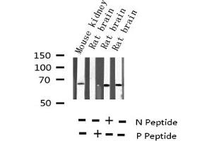 Western blot analysis of Phospho-NF kappaB p65 (Thr435) expression in various lysates (NF-kB p65 anticorps  (pThr435))