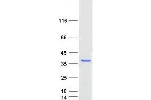 Validation with Western Blot