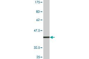 Western Blot detection against Immunogen (38. (ARHGEF6 anticorps  (AA 61-175))