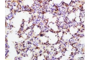 Paraformaldehyde-fixed, paraffin embedded rat lung, Antigen retrieval by boiling in sodium citrate buffer (pH6.