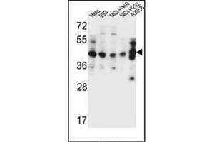 Western blot analysis of GTF2H2C Antibody (C-term) in Hela, 293, NCI-H460, NCI-H292, A2058 cell line lysates (35ug/lane). (GTF2H2C anticorps  (C-Term))