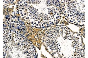 ABIN6263526 and ABIN6279596 at 1/100 staining mouse testis tissue by IHC-P. (NBPF3 anticorps  (Internal Region))