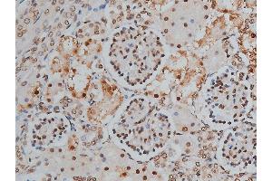 ABIN6255746 and ABIN6268991 at 1/200 staining human kidney tissue sections by IHC-P. (PPP1R12A anticorps  (pThr853))