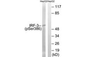 Western blot analysis of extracts from HepG2 cells treated with EGF 200ng/ml 30', using IRF-3 (Phospho-Ser386) Antibody. (IRF3 anticorps  (pSer386))