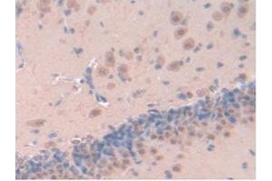IHC-P analysis of Rat Brain Tissue, with DAB staining. (Leptin anticorps  (AA 22-167))