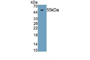 Detection of Recombinant TFPI, Human using Monoclonal Antibody to Tissue Factor Pathway Inhibitor (TFPI)
