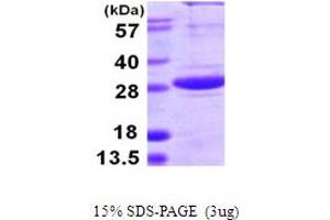SDS-PAGE (SDS) image for SplA/ryanodine Receptor Domain and SOCS Box Containing 1 (SPSB1) (AA 24-233) protein (His tag) (ABIN667909)