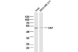 Lane 1: Hela lysates Lane 2: MDA-MB-231 lysates probed with CK7 Polyclonal Antibody, Unconjugated  at 1:300 dilution and 4˚C overnight incubation. (Cytokeratin 7 anticorps)