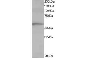 ABIN185185 staining (1 ug/ml) of Human Lung lysate (RIPA buffer, 35 ug total protein per lane). (TCP1 alpha/CCTA anticorps  (C-Term))