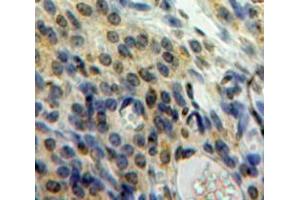 Used in DAB staining on fromalin fixed paraffin-embedded Ovary tissue (HMGN1 anticorps  (AA 14-100))