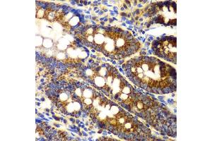 Immunohistochemistry of paraffin-embedded rat Intestine using TNFSF11 antibody (ABIN6290161) at dilution of 1:100 (40x lens). (RANKL anticorps)