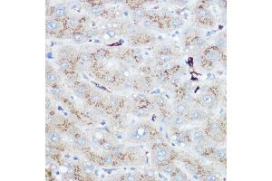 Immunohistochemistry of paraffin-embedded human liver using Heme Oxygenase 1 (HO-1/HMOX1) Rabbit pAb (ABIN3021906, ABIN3021907, ABIN3021908 and ABIN6217466) at dilution of 1:100 (40x lens).