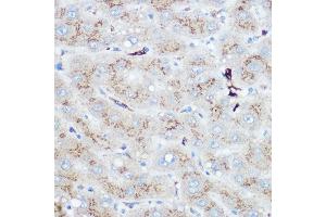 Immunohistochemistry of paraffin-embedded human liver using Heme Oxygenase 1 (HO-1/HMOX1) Rabbit pAb (ABIN3021906, ABIN3021907, ABIN3021908 and ABIN6217466) at dilution of 1:100 (40x lens). (HMOX1 anticorps  (AA 1-288))