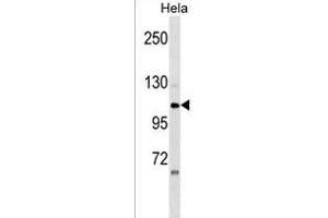 ZNF33A Antibody (N-term) (ABIN1539574 and ABIN2849907) western blot analysis in Hela cell line lysates (35 μg/lane). (ZNF33A anticorps  (N-Term))